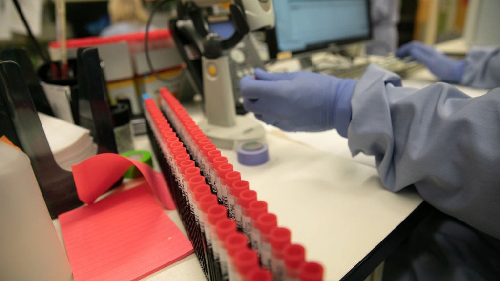 Is the Virus Changing? COVID-19 Symptoms Appearing Later Than Usual in Some New Patients
