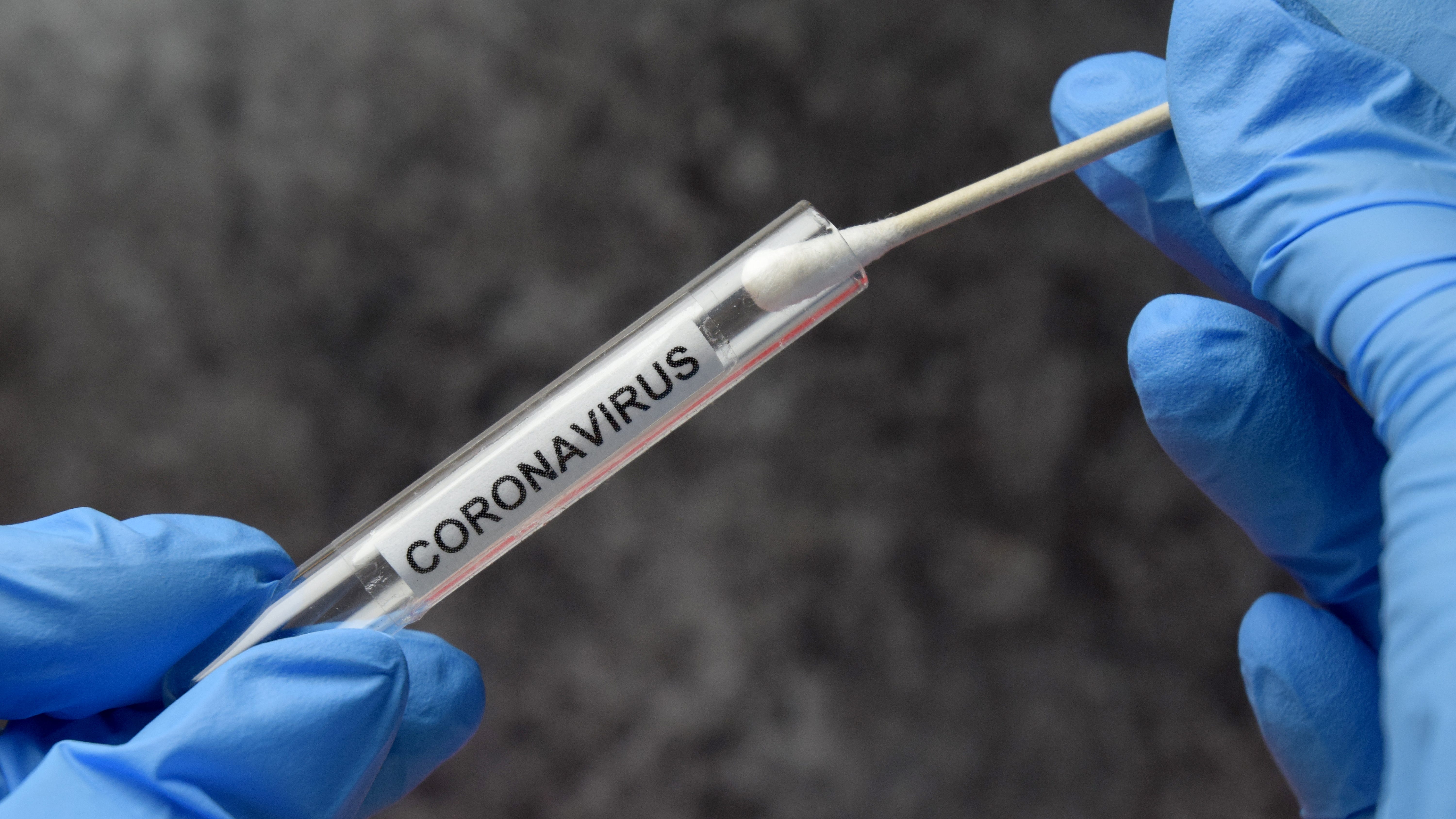 Suburban man facing federal charges in COVID-19 testing fraud scheme