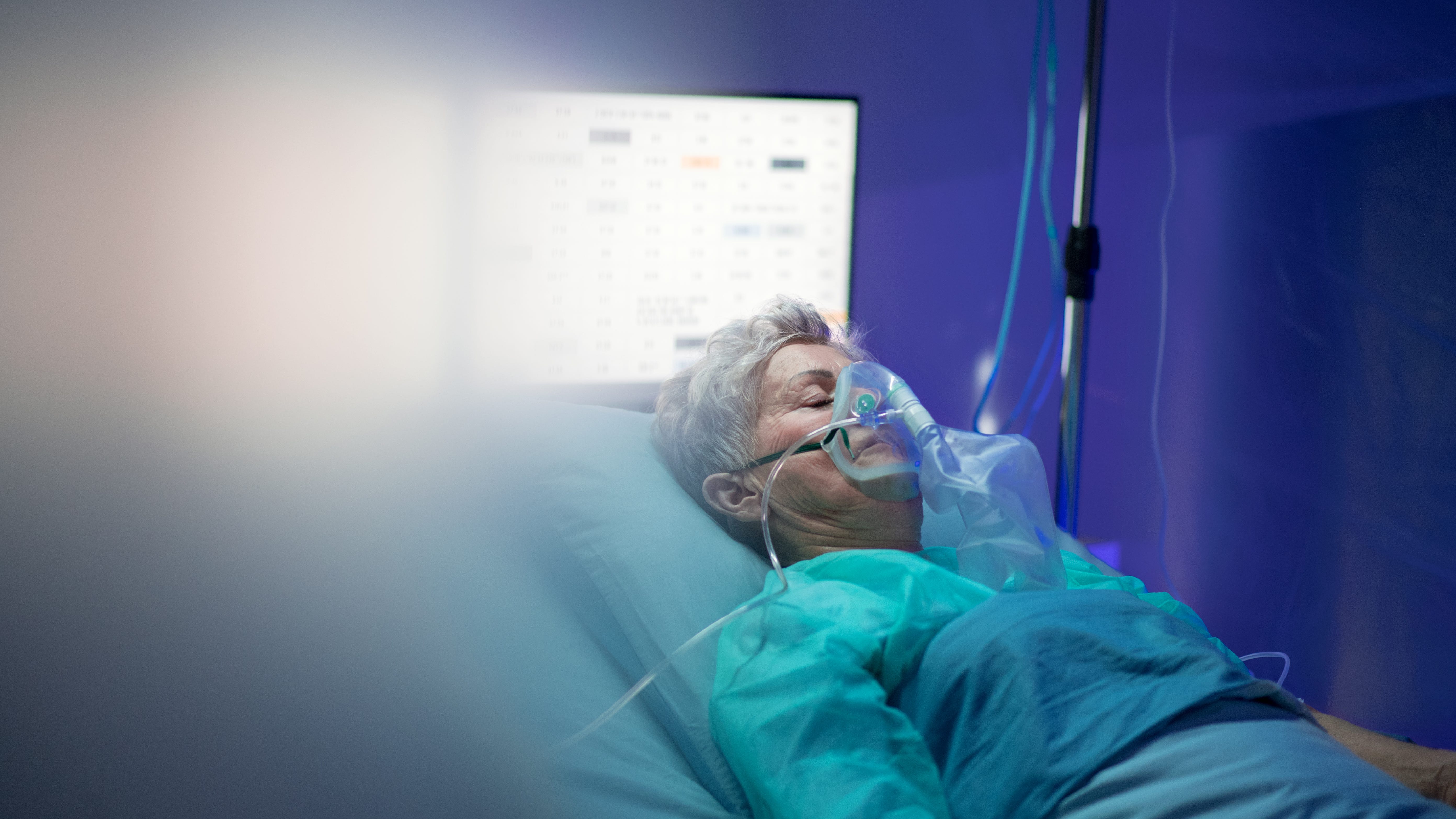 Doctors see rise in amputation rates among diabetes patients during COVID-19 crisis