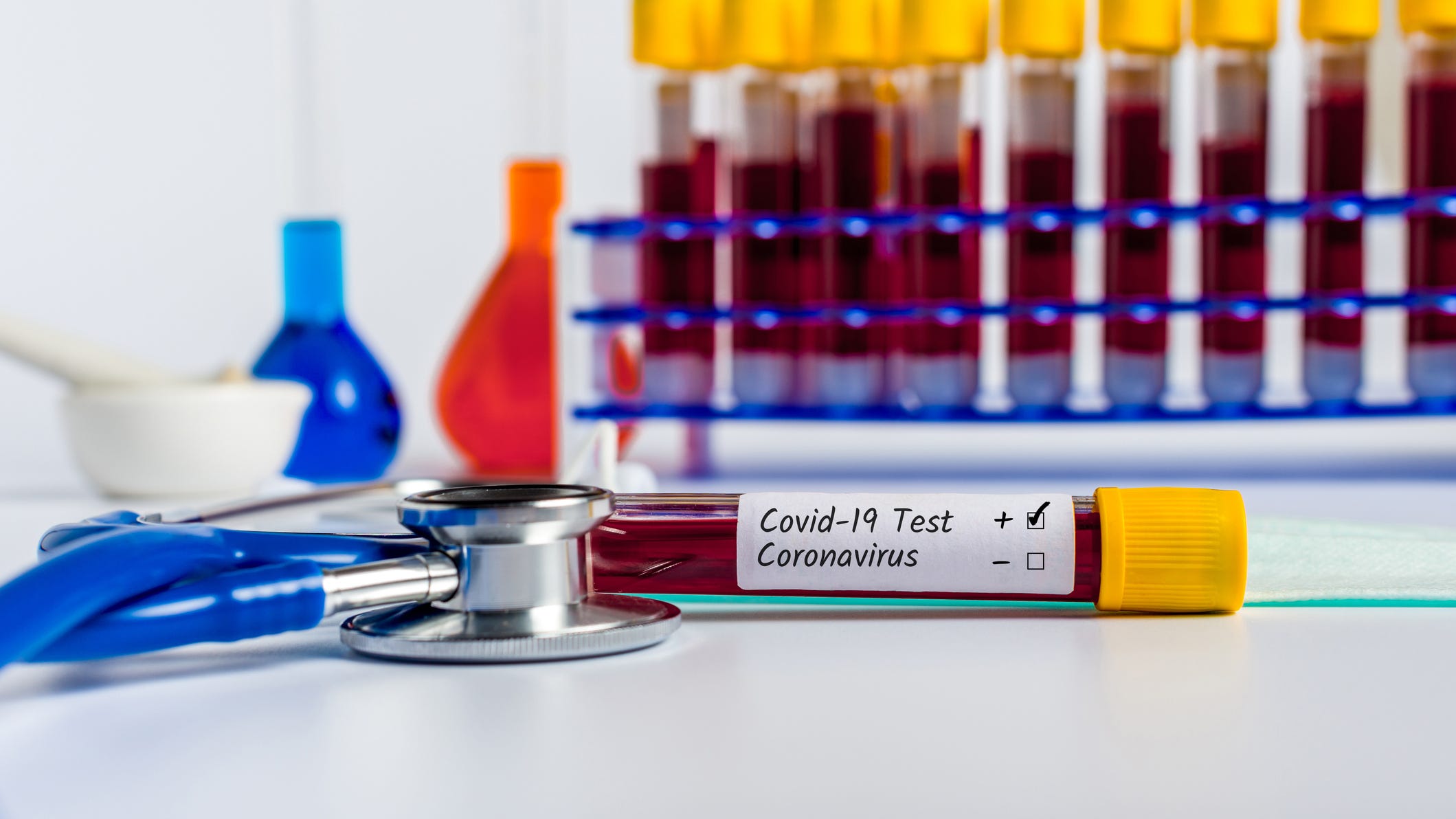 World Health Organization Says There Is ‘No Evidence’ You Can’t Get Coronavirus Twice