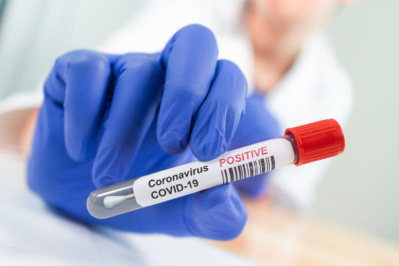 COVID-19 test