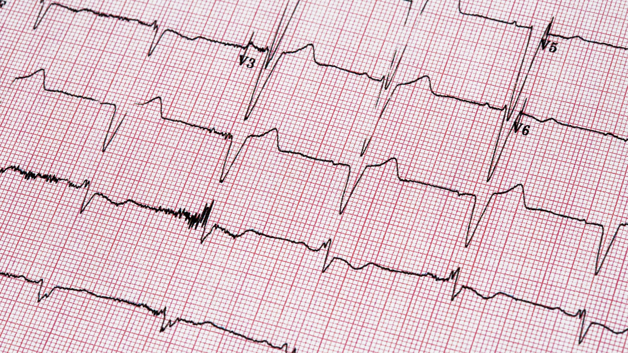 Bucks researchers testing new method to treat old heart problem