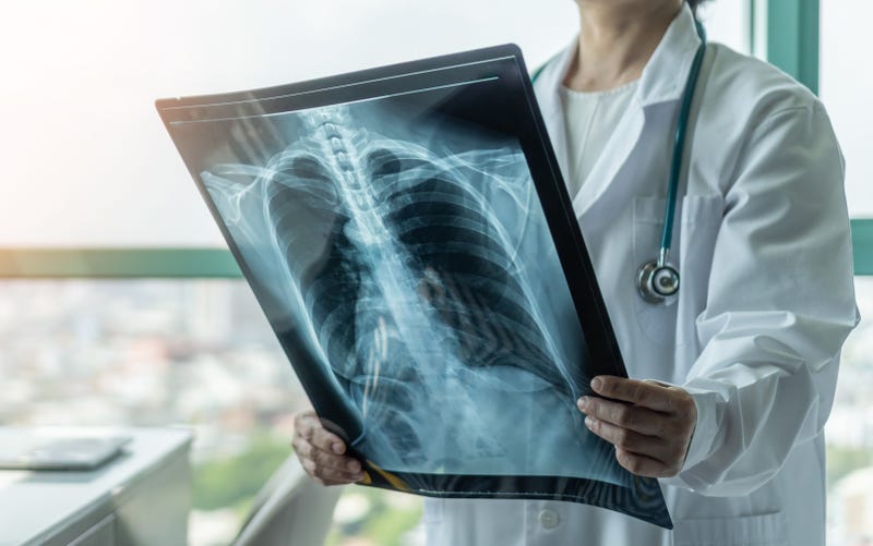 Two years into the pandemic, scientists have discovered that COVID-19 is impacting organs in the body differently than it was in March of 2020.