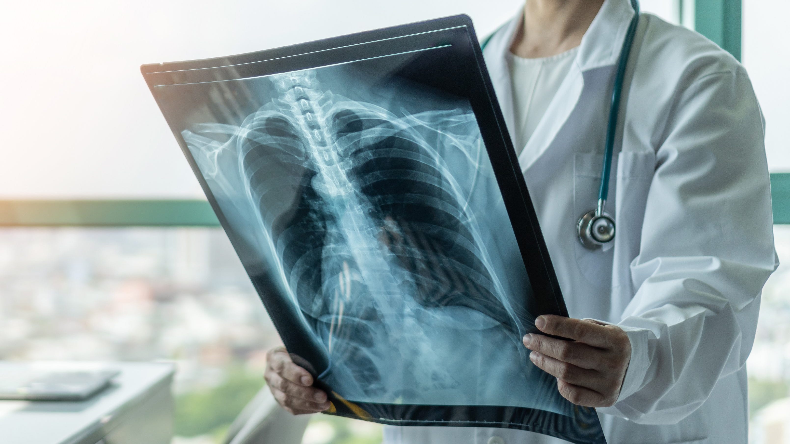 Subvariants impact organs differently than original COVID-19, health expert says