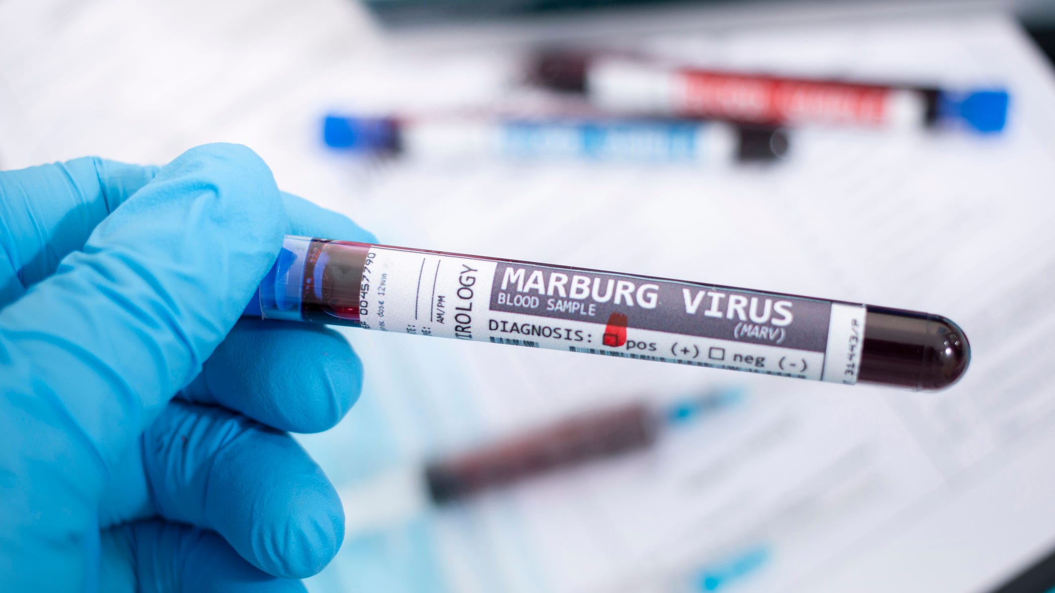 Everything you need to know about the Marburg virus