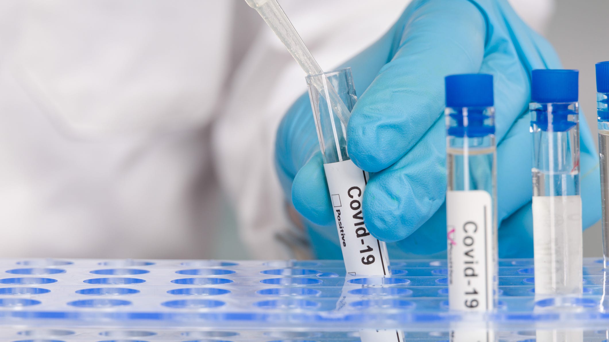 Allegheny County reports 620 new COVID-19 cases Wednesday