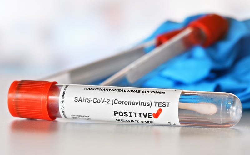 Positive test
