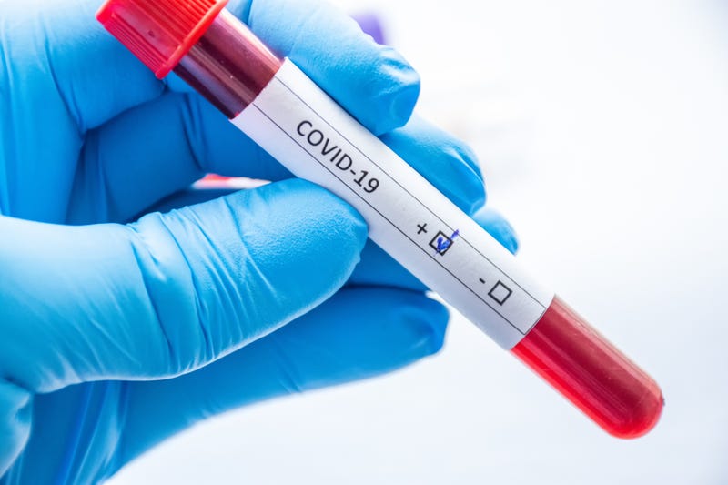 The number of new COVID-19 infections in Los Angeles County again pushed over the 500 mark Wednesday, while the number of people hospitalized reached nearly 300. (Getty Images)