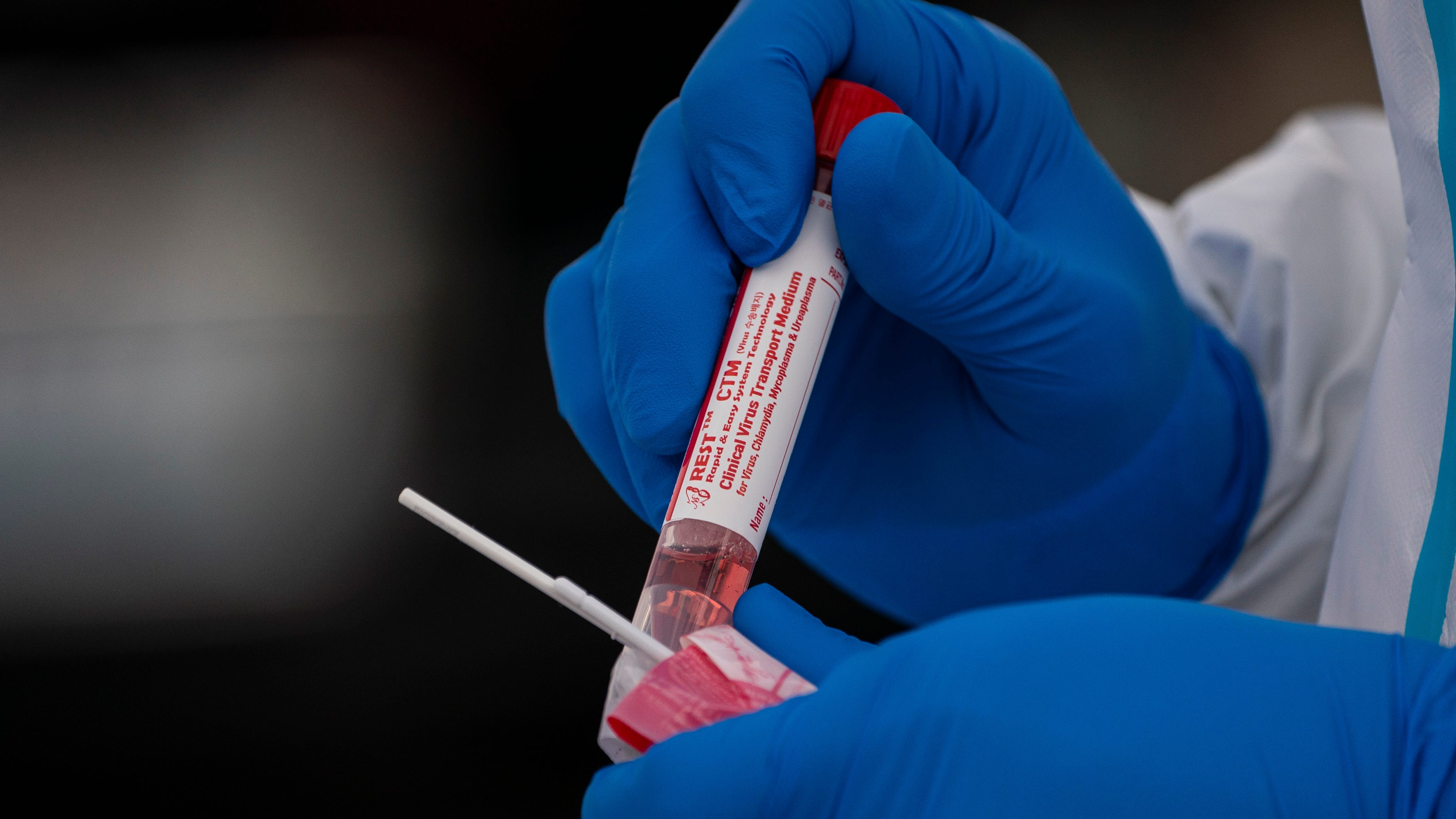 Doctor: Wait a few days after COVID exposure for a more accurate test result