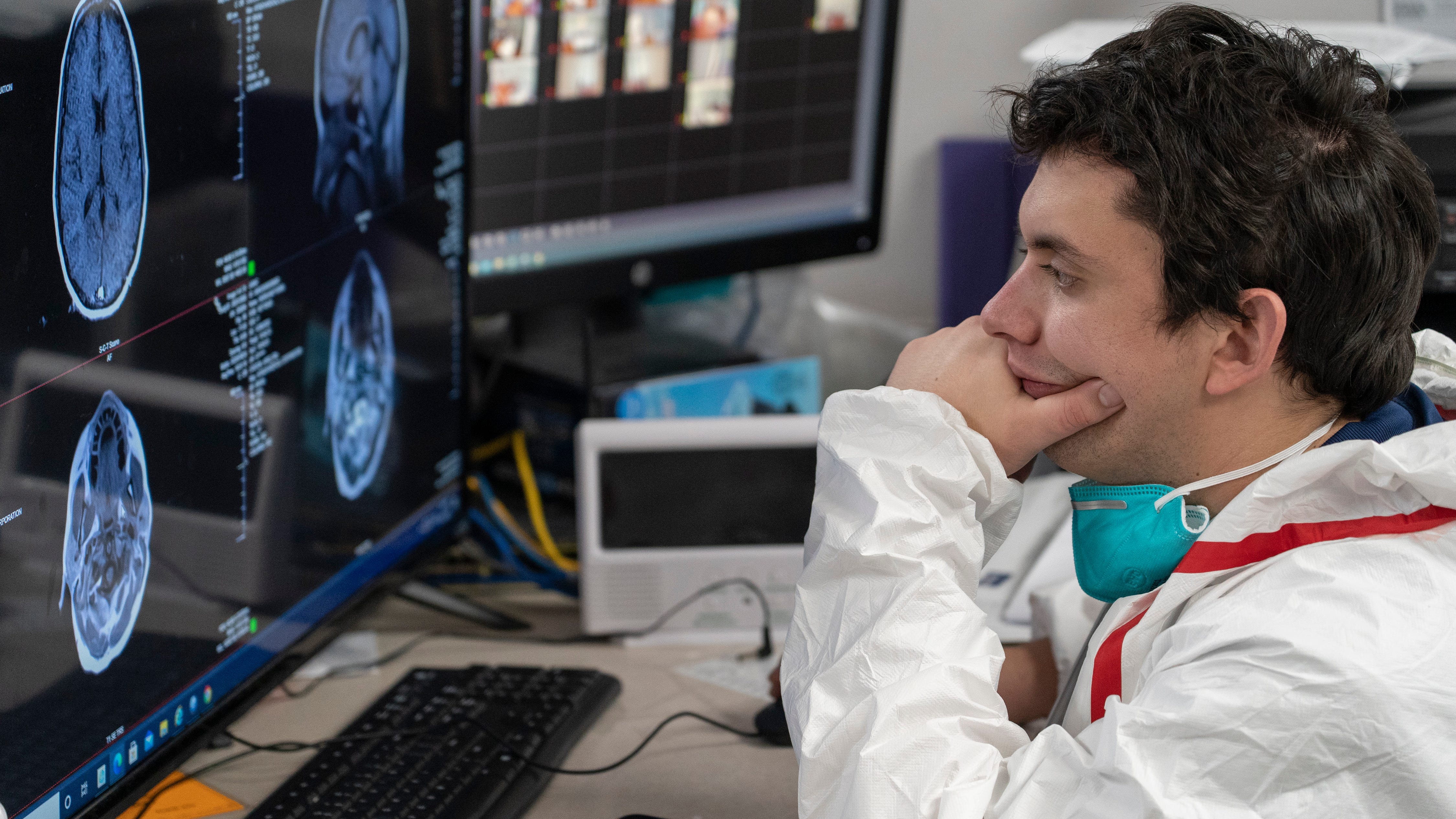 COVID-19 may reduce brain tissue and impair memory function: study