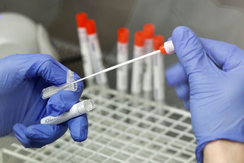 A lab technician is working on smears for PCR tests for Covid-19 during the coronavirus pandemic on February 22, 2021 in the Labor Dr. Krause & Kollegen laboratory in Kiel, Germany. 