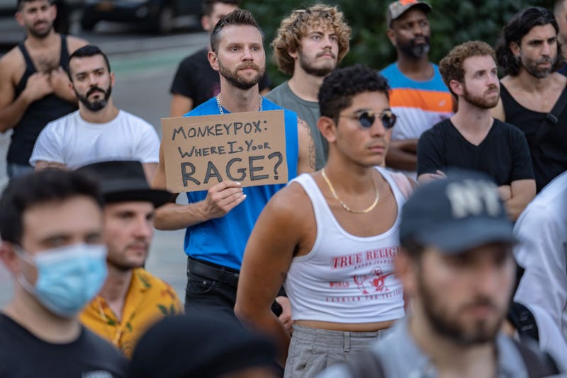 People protest during a rally calling for more government action to combat the spread of monkeypox at Foley Square on July 21, 2022 in New York City.