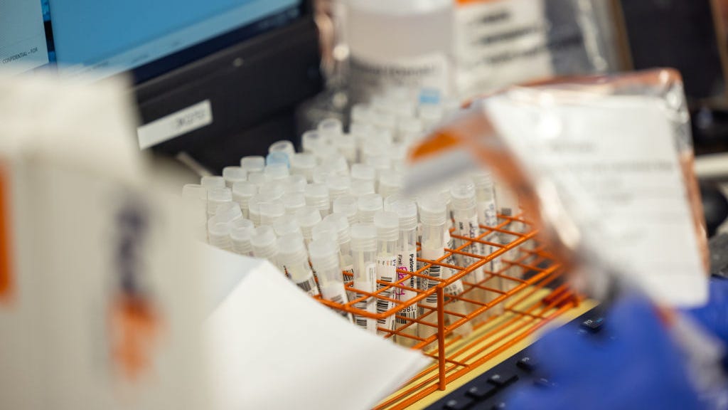 Riverside County confirms 1st pediatric MPX case