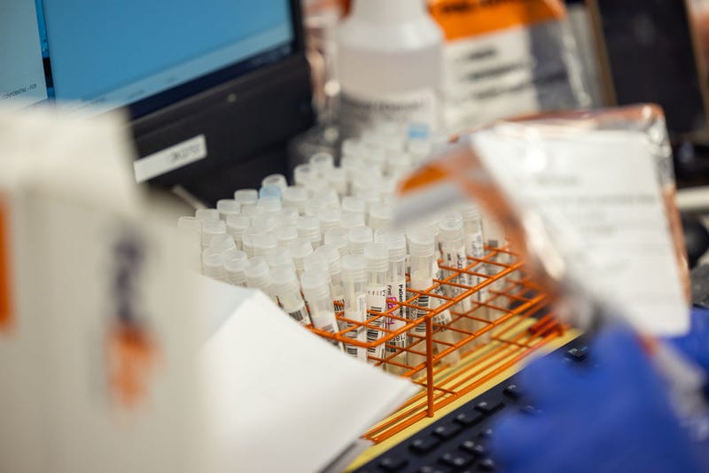Microbiologists process Monkeypox tests.