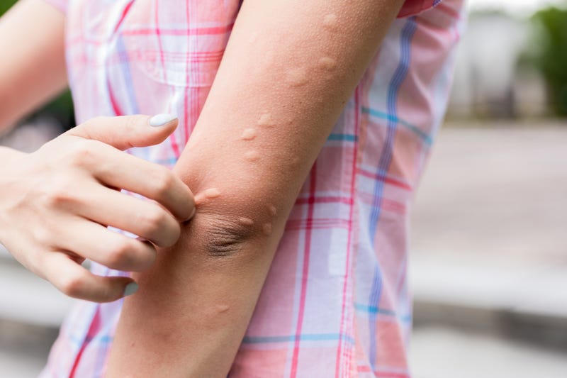 Are you a mosquito magnet? It could be your smell
