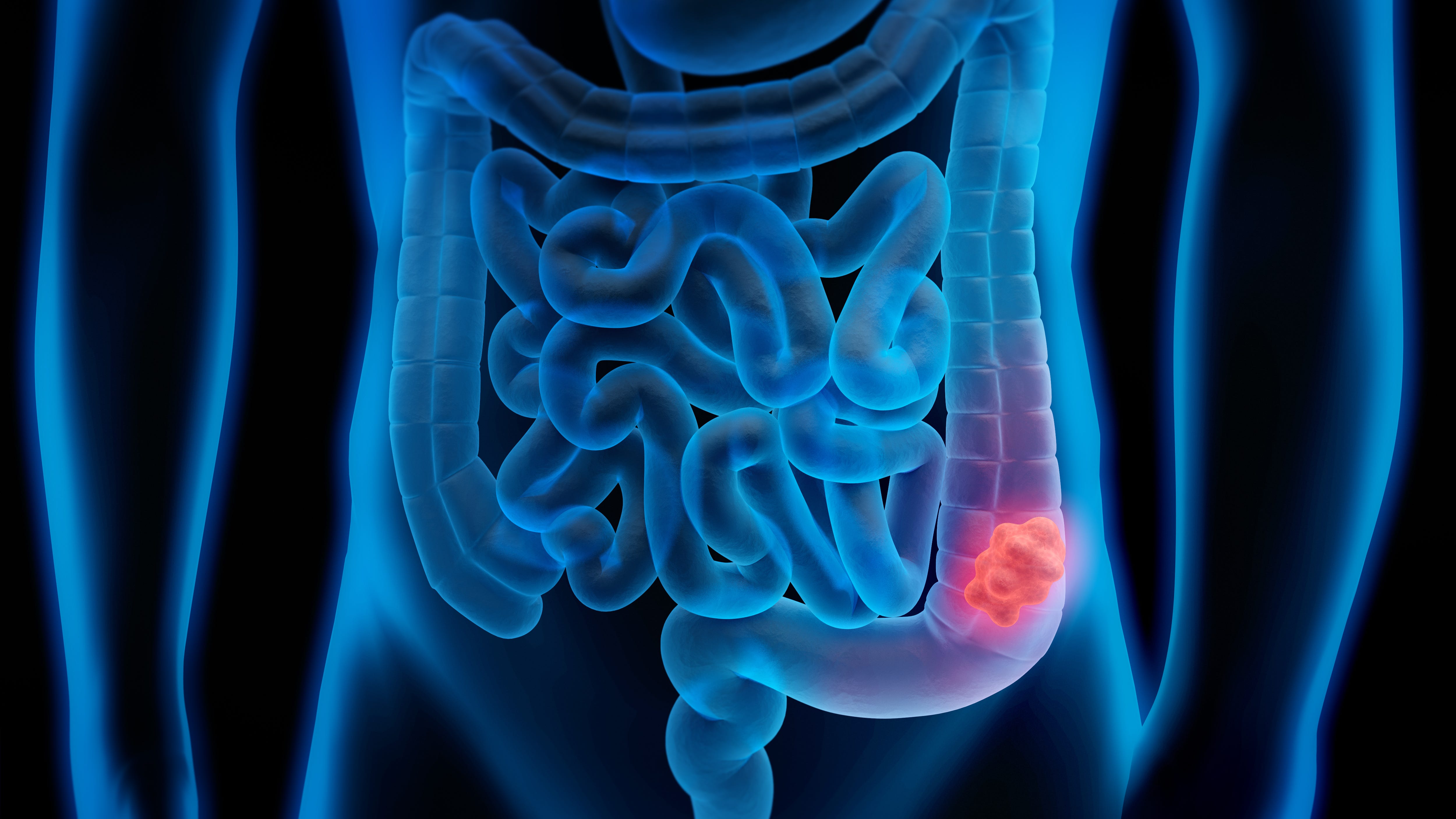 KYW Medical Report: Cancer screenings are more important than ever