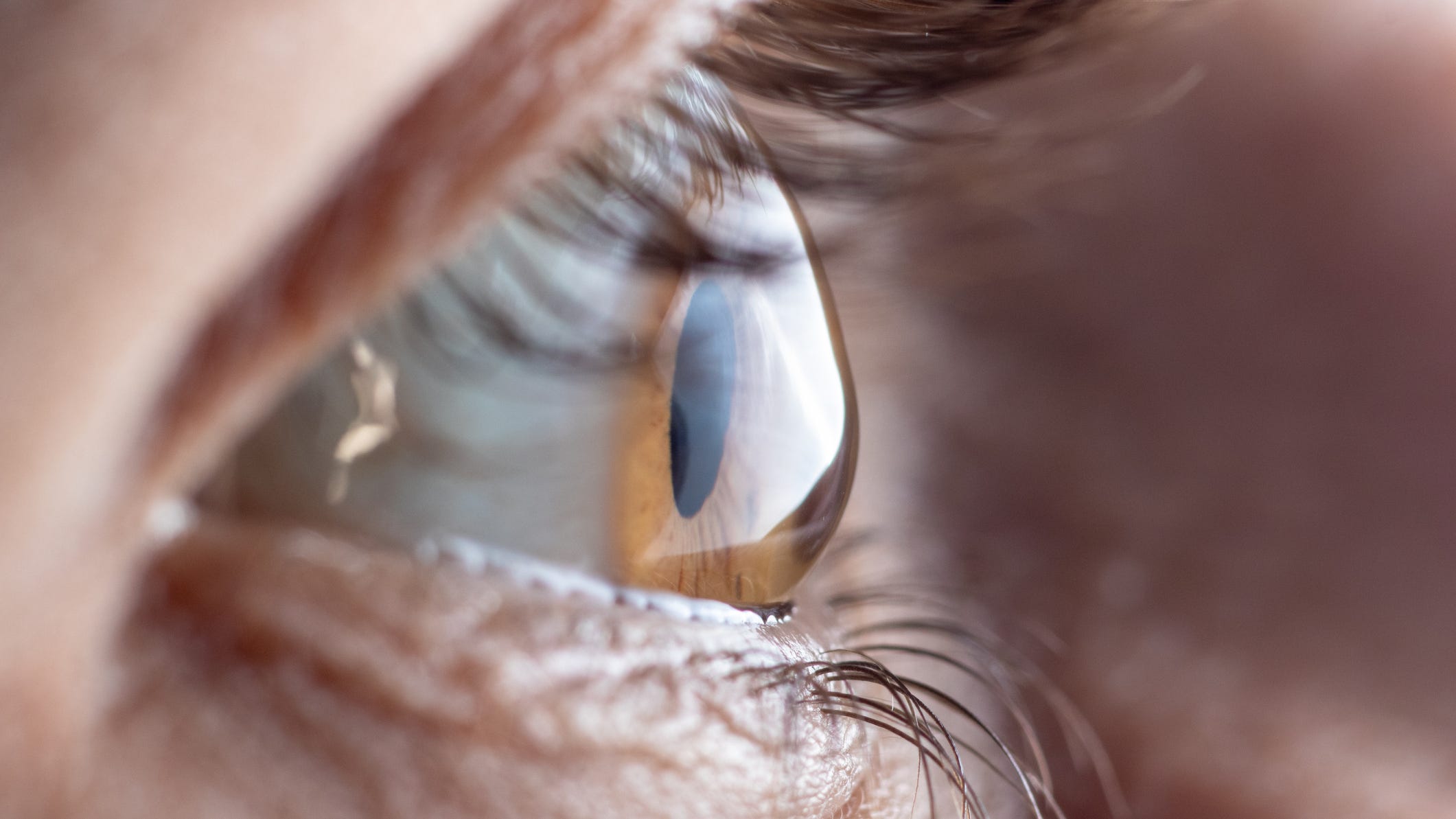 Eye implant from pig protein restores sight in the blind