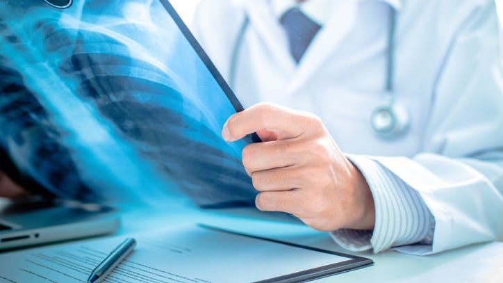 Study suggests there is hidden lung damage in those with long COVID