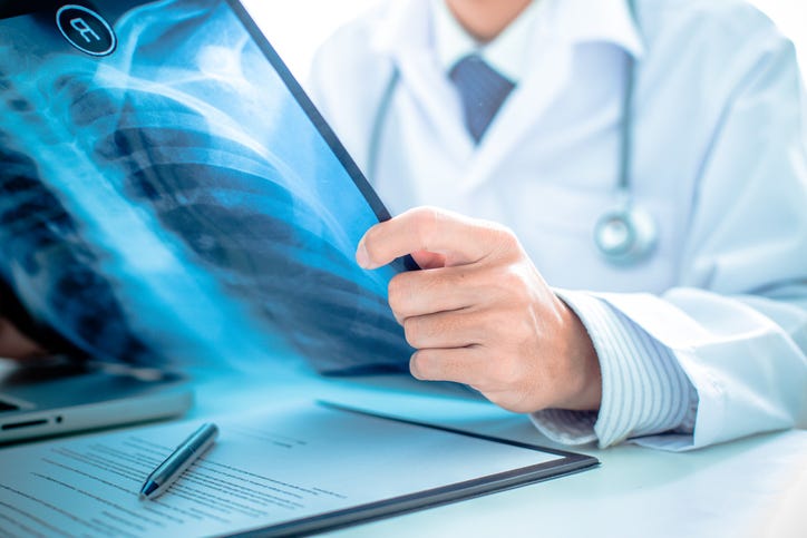 Doctor examining lung scans.
