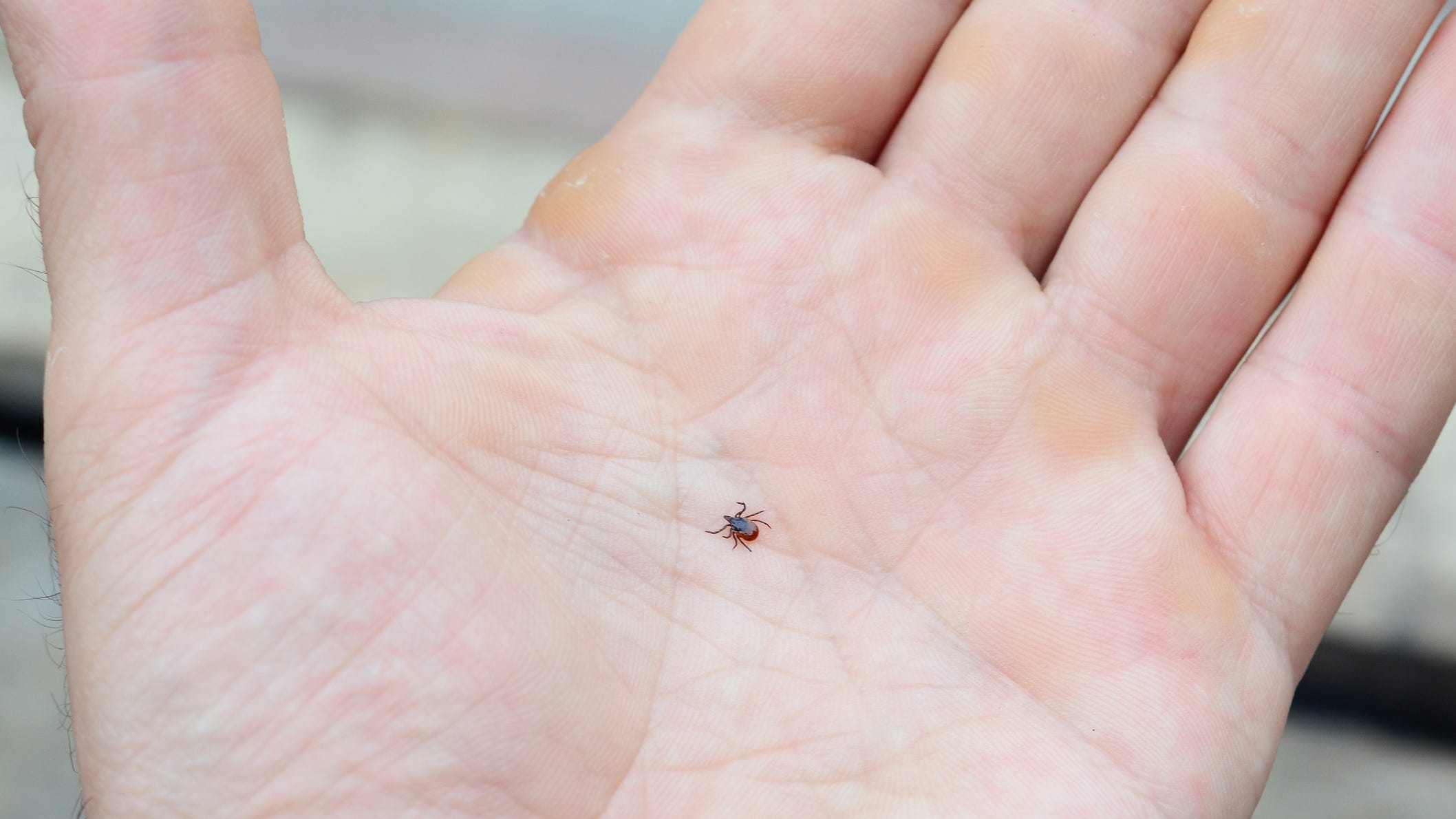 Check your legs, it's the height of tick season