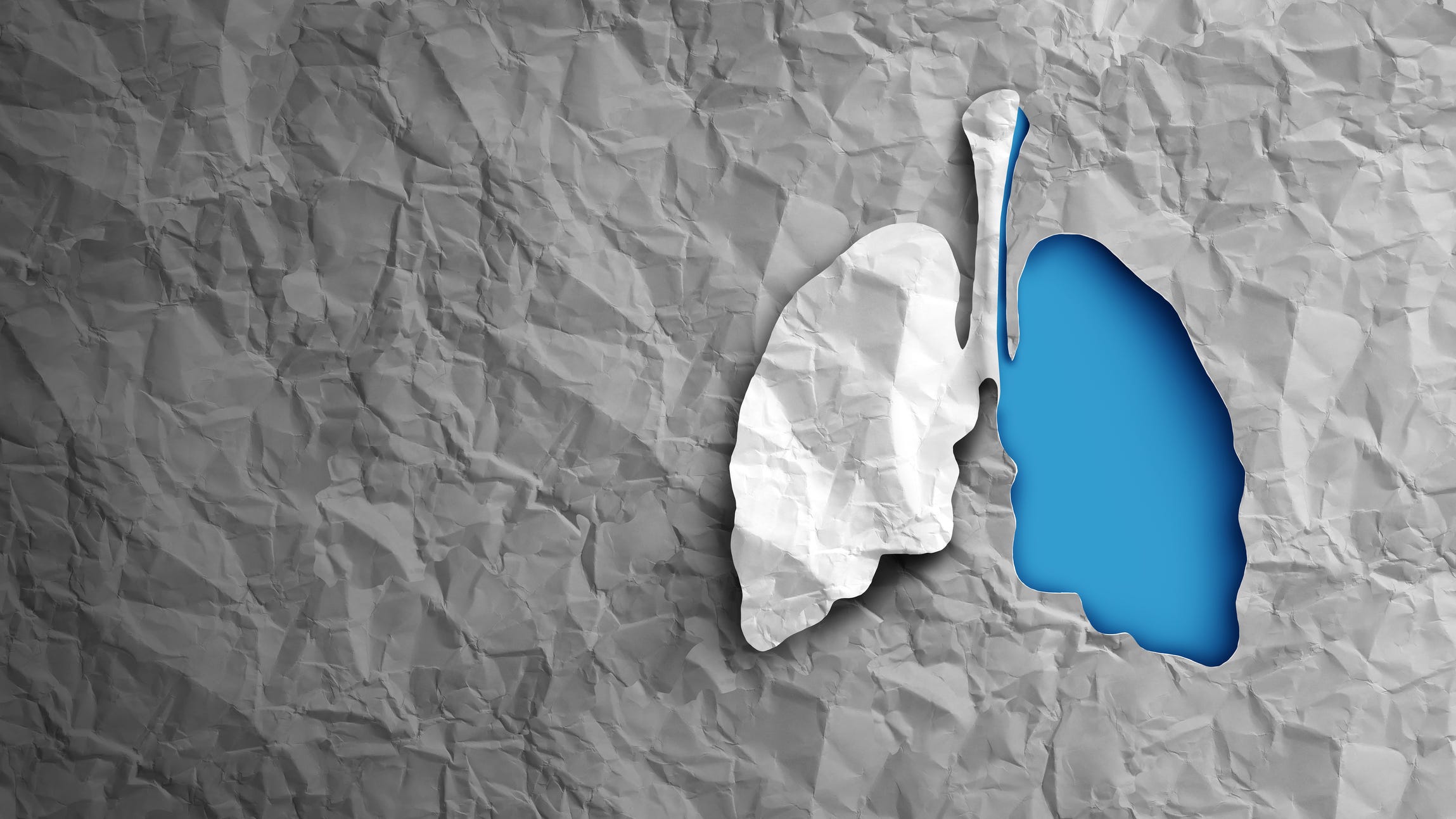 About 10% of all U.S. lung transplants are for COVID patients… and the numbers are rising