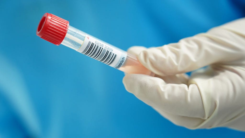 Here’s how to tell people that you have COVID-19