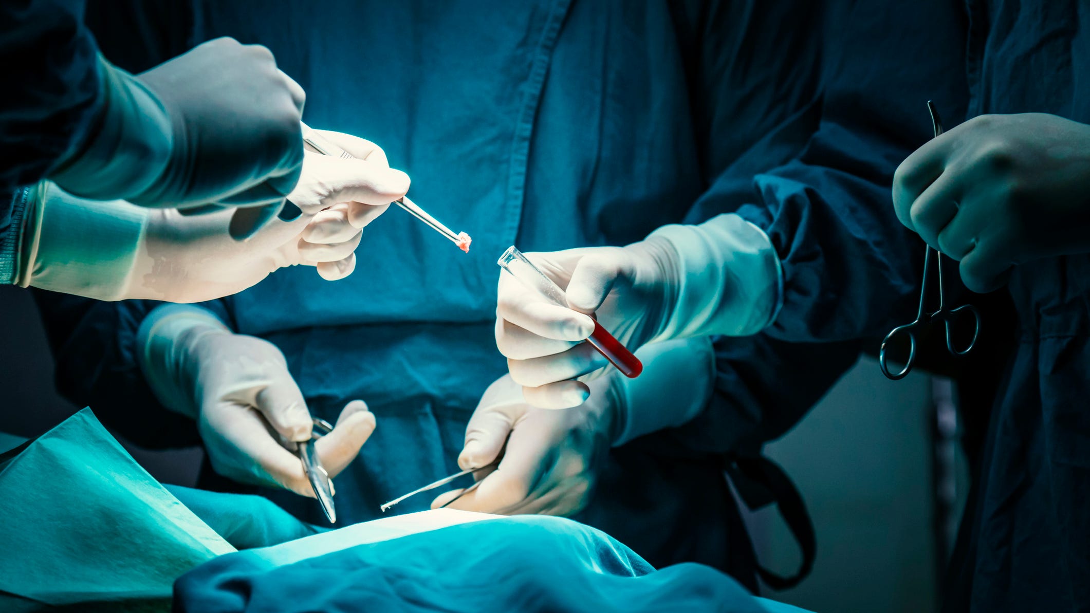Fresno woman sues after surgeon takes out her spleen and not kidney