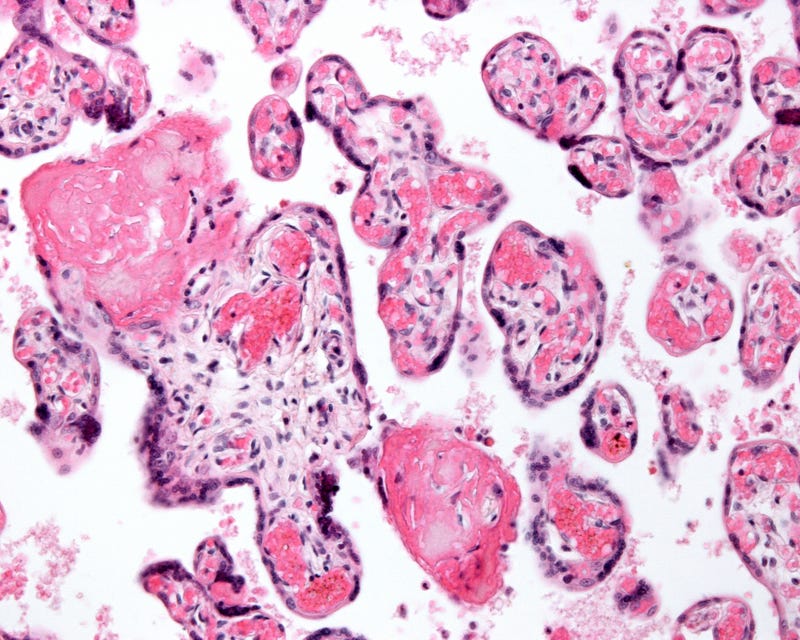 Placenta stock photo.