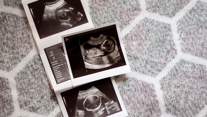 Woman wins $5M after IVF doc uses own sperm to father her child