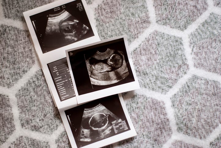 ultrasound