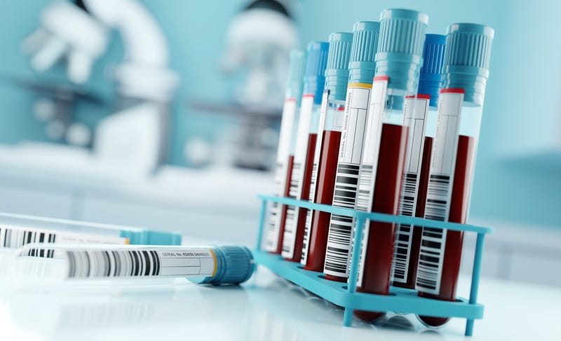 Blood tests