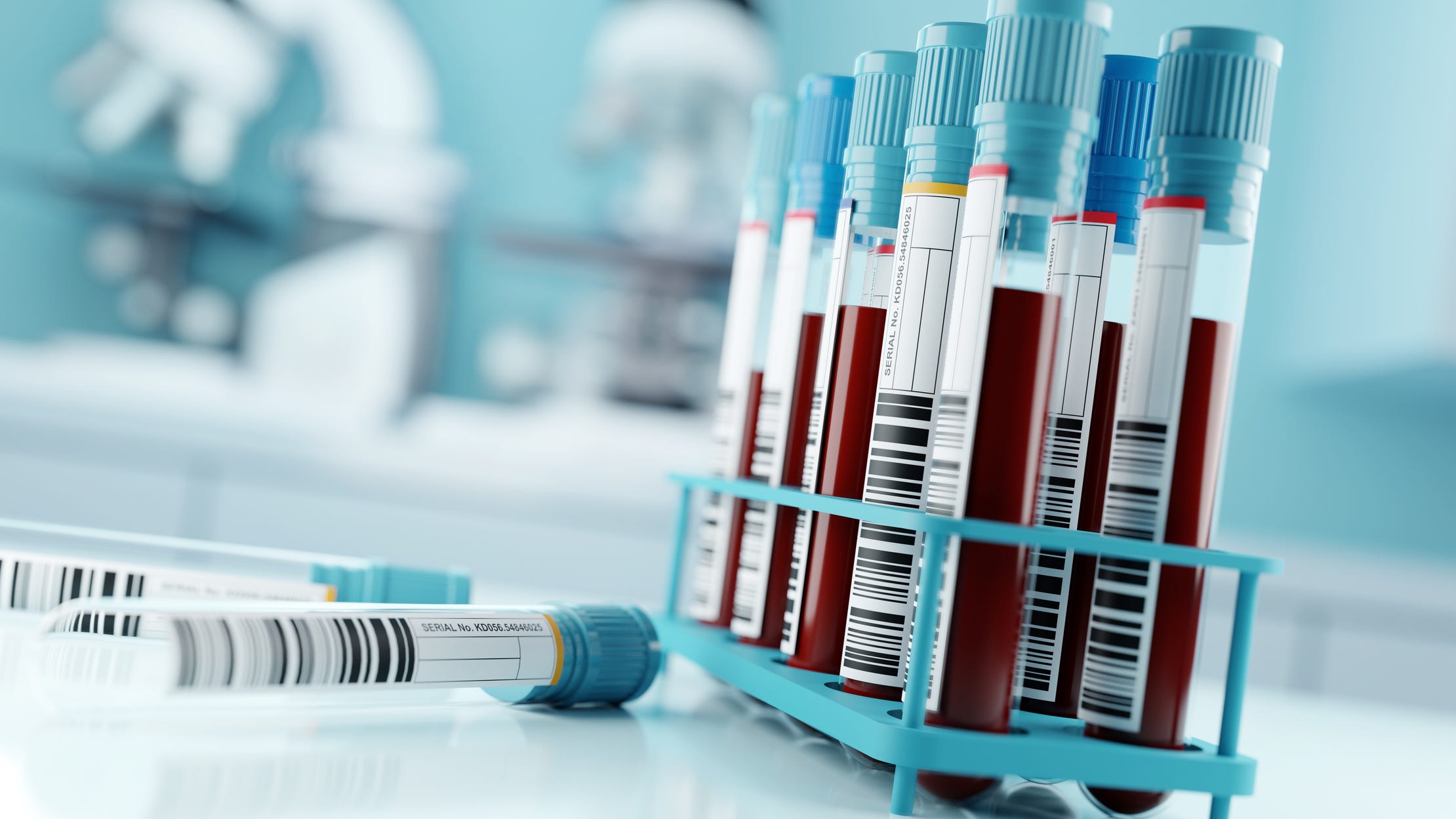 UCLA-led team may have found way to kill HIV-infected cells