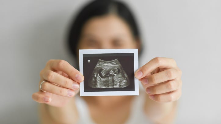 NJ woman thought she had 'long COVID,' but really she was pregnant