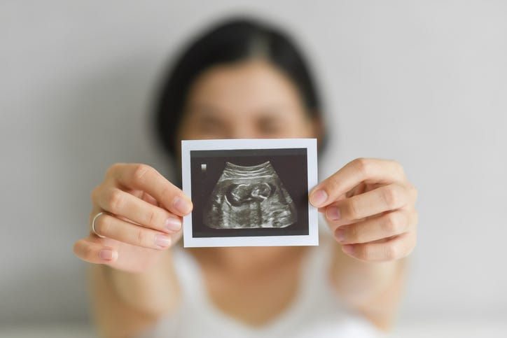 pregnancy ultrasound