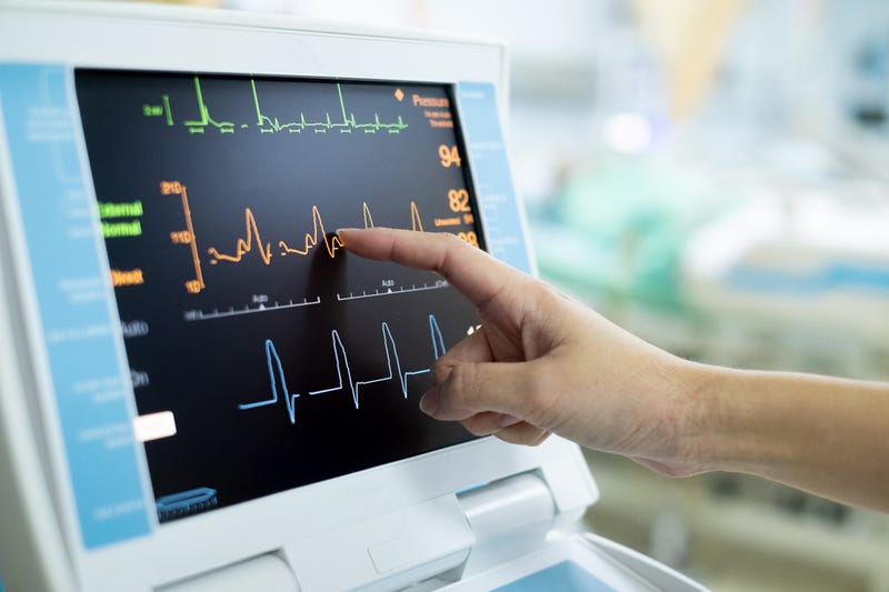 Heart monitor