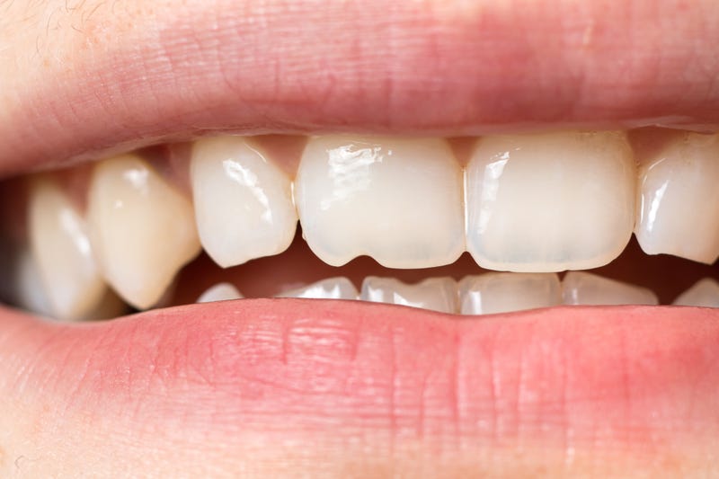 Human Teeth