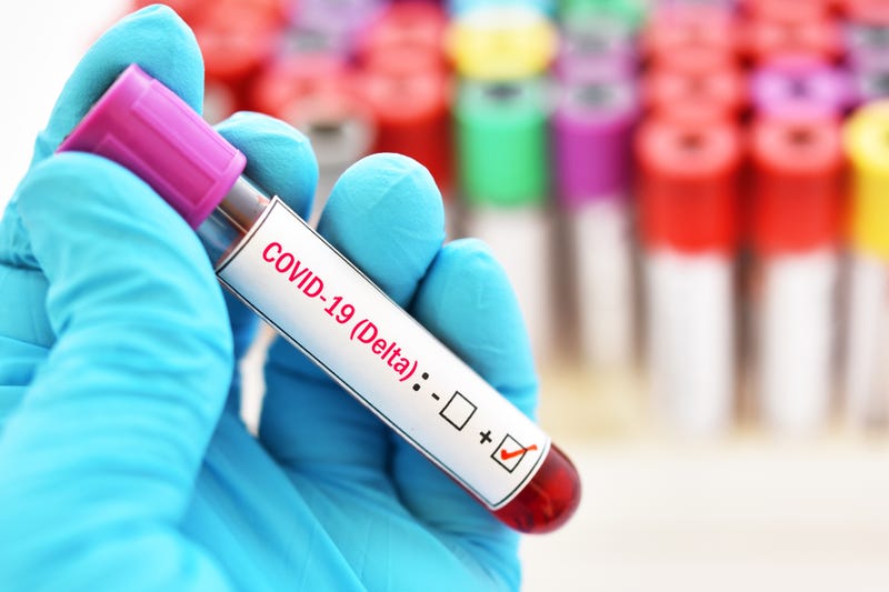 Blood sample positive with delta variant COVID-19 virus