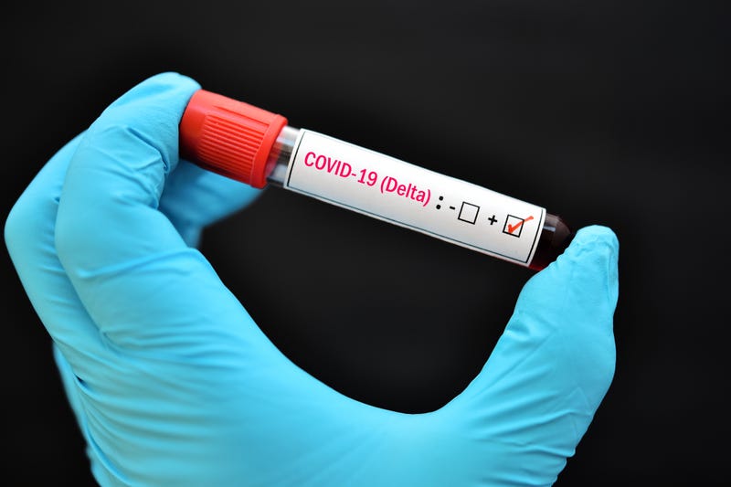 Delta variant COVID-19 positive, blood sample tube positive with Delta variant of COVID-19