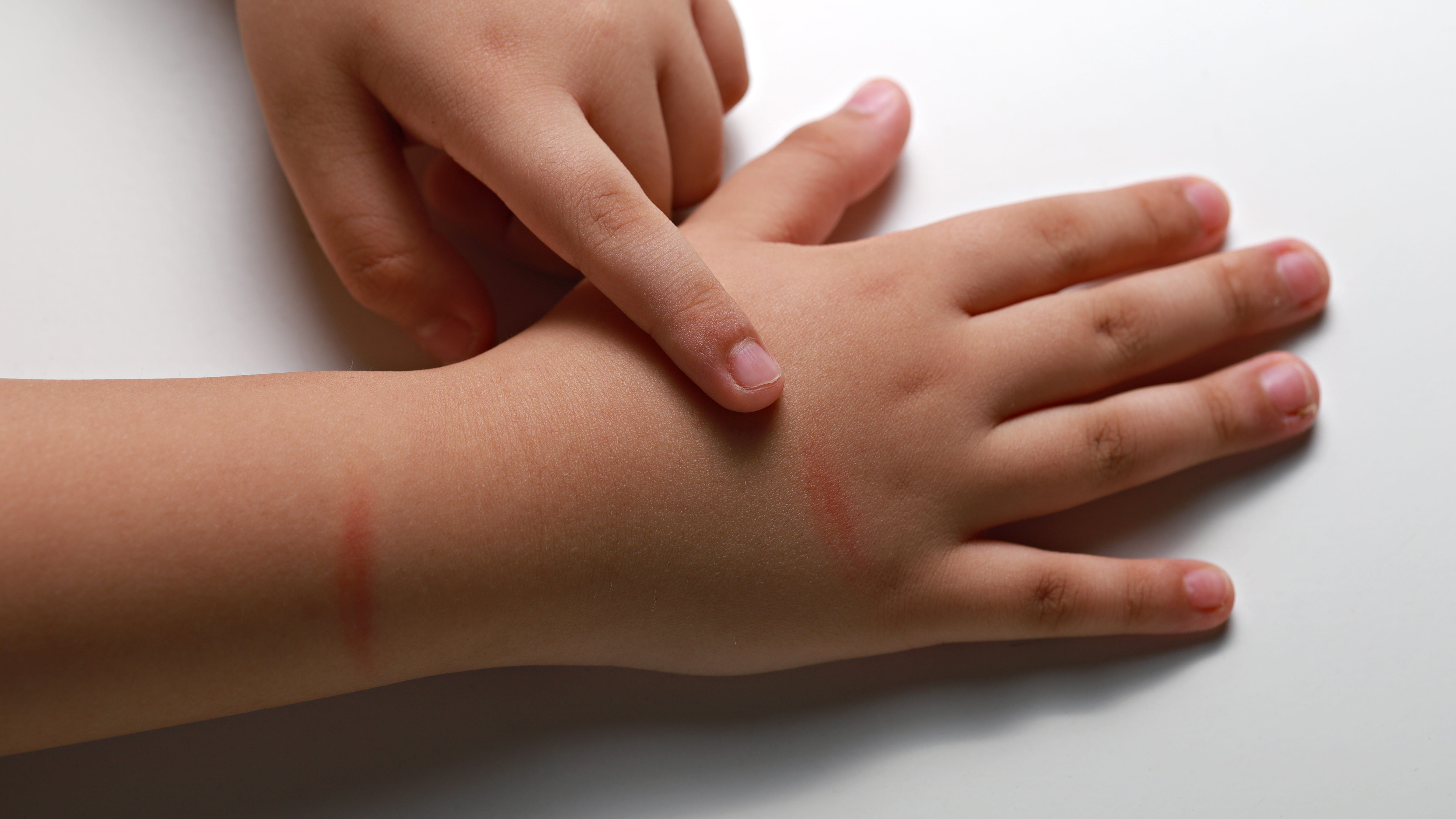 Kane County needs more volunteers for kids in need as child abuse cases surge