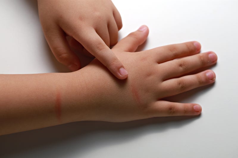 More volunteers needed for kids in need as child abuse cases surge in Kane County