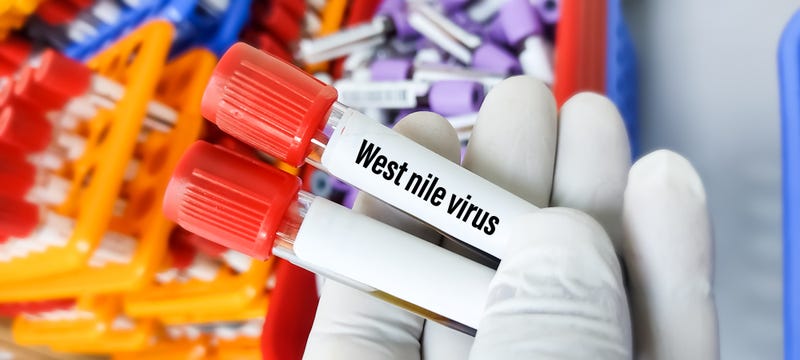 West nile virus