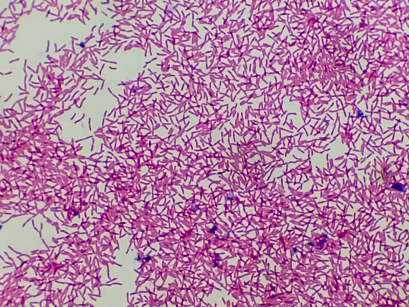 E. coli