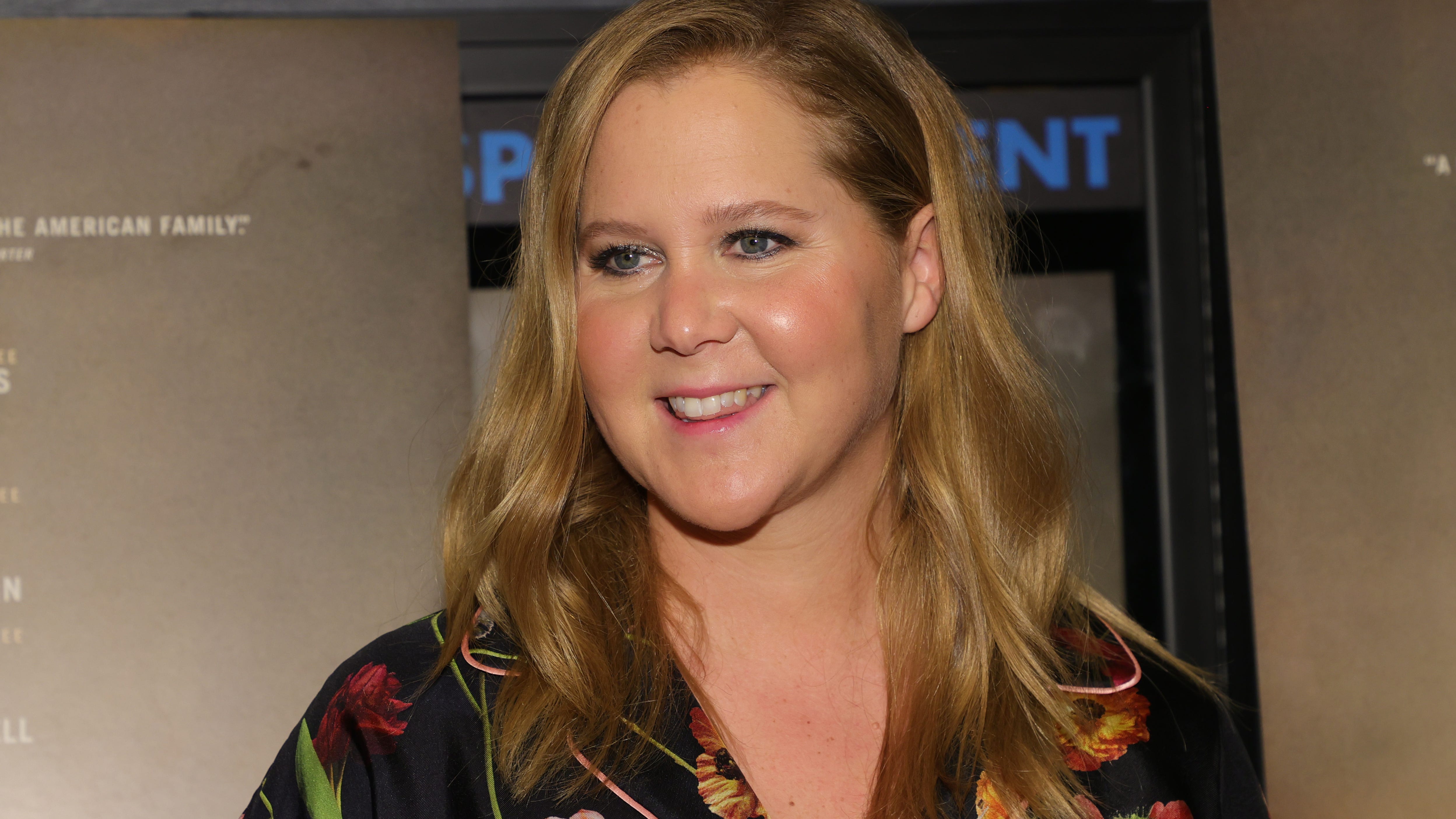 Amy Schumer reveals she got cheek fillers dissolved: 'Turns out I was already full'