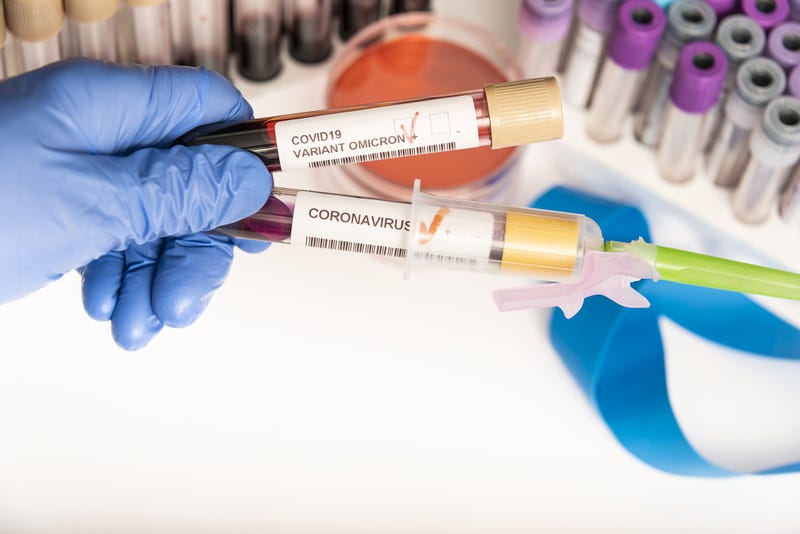COVID-19 blood samples stock photo. 