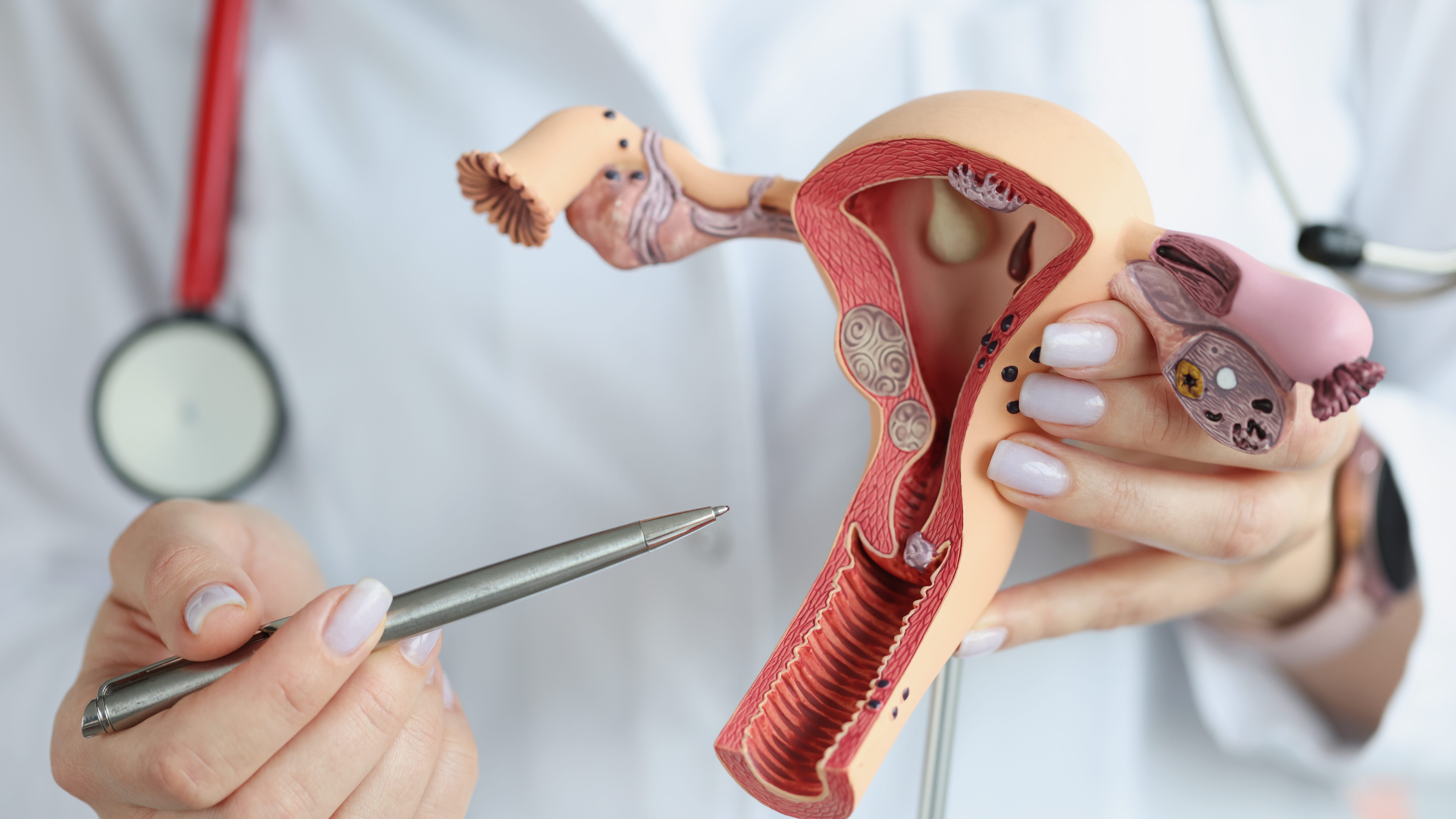 KYW Medical Report: Genetic testing can help determine ovarian cancer risk