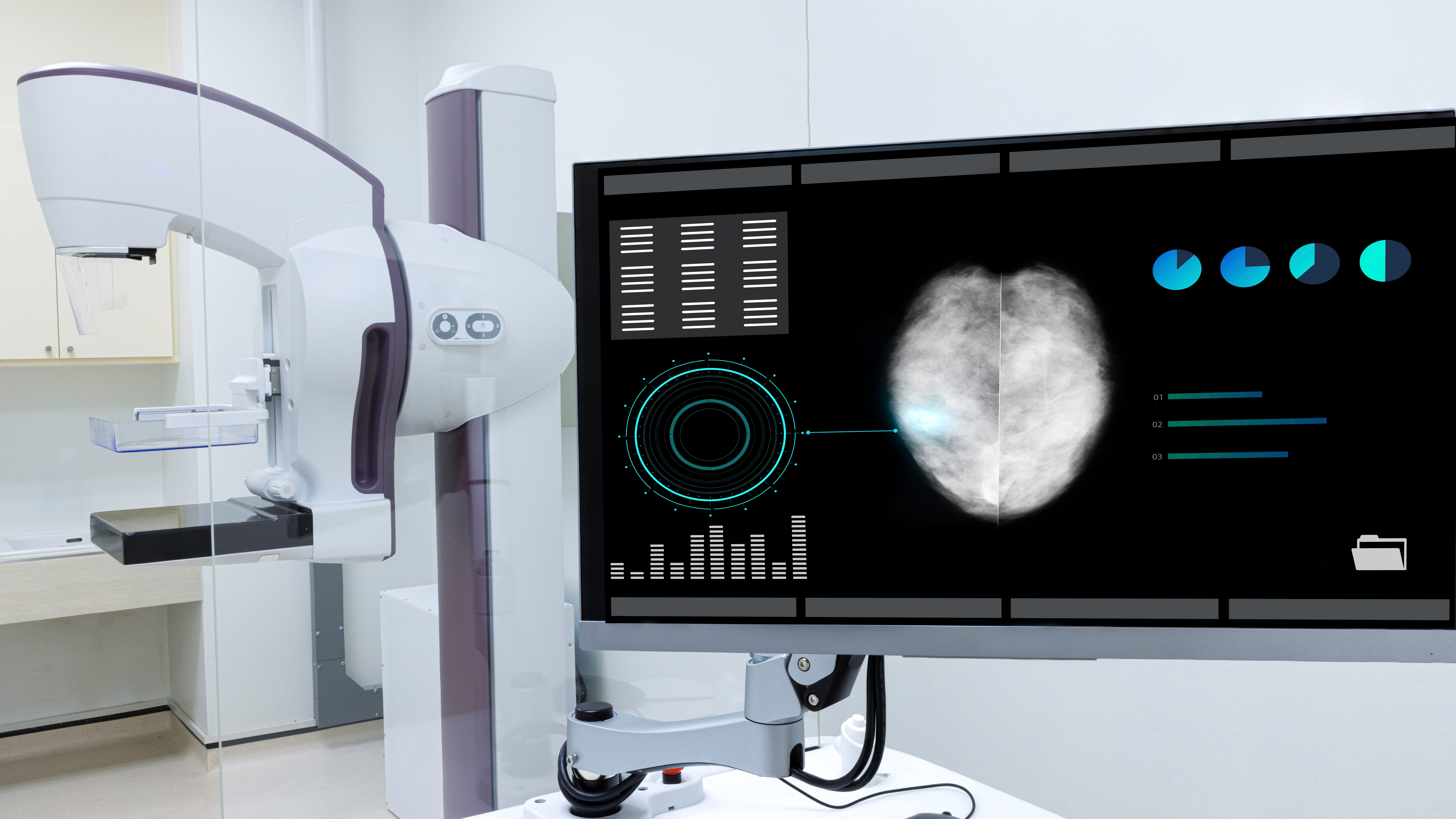 Local tech expert explains capability of AI reading mammograms, detecting breast cancer