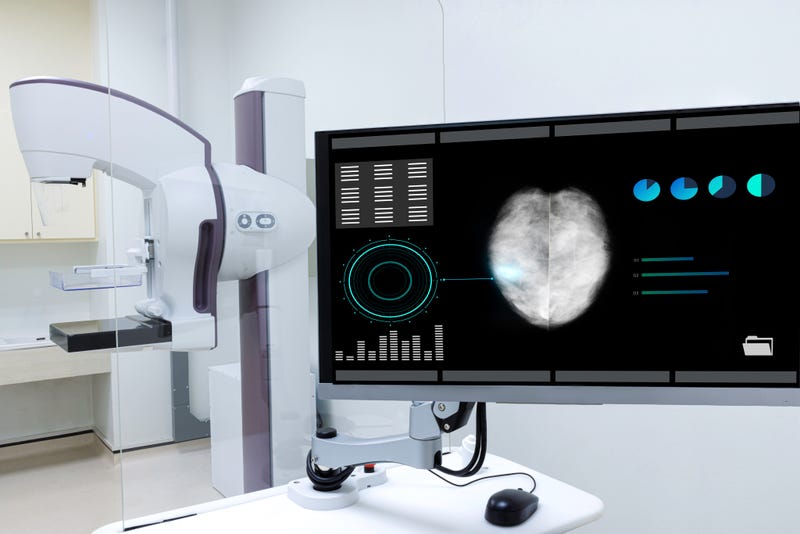 AI breast cancer