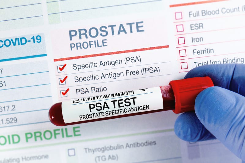 Prostate Cancer