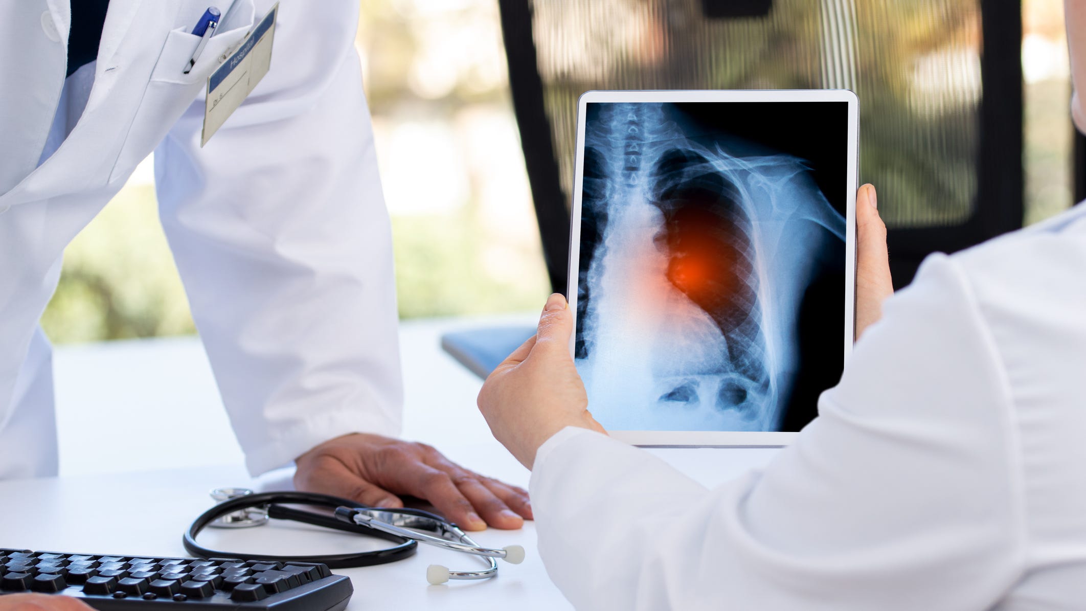 Long COVID 'affects a lot of people' even with vaccine, health expert warns