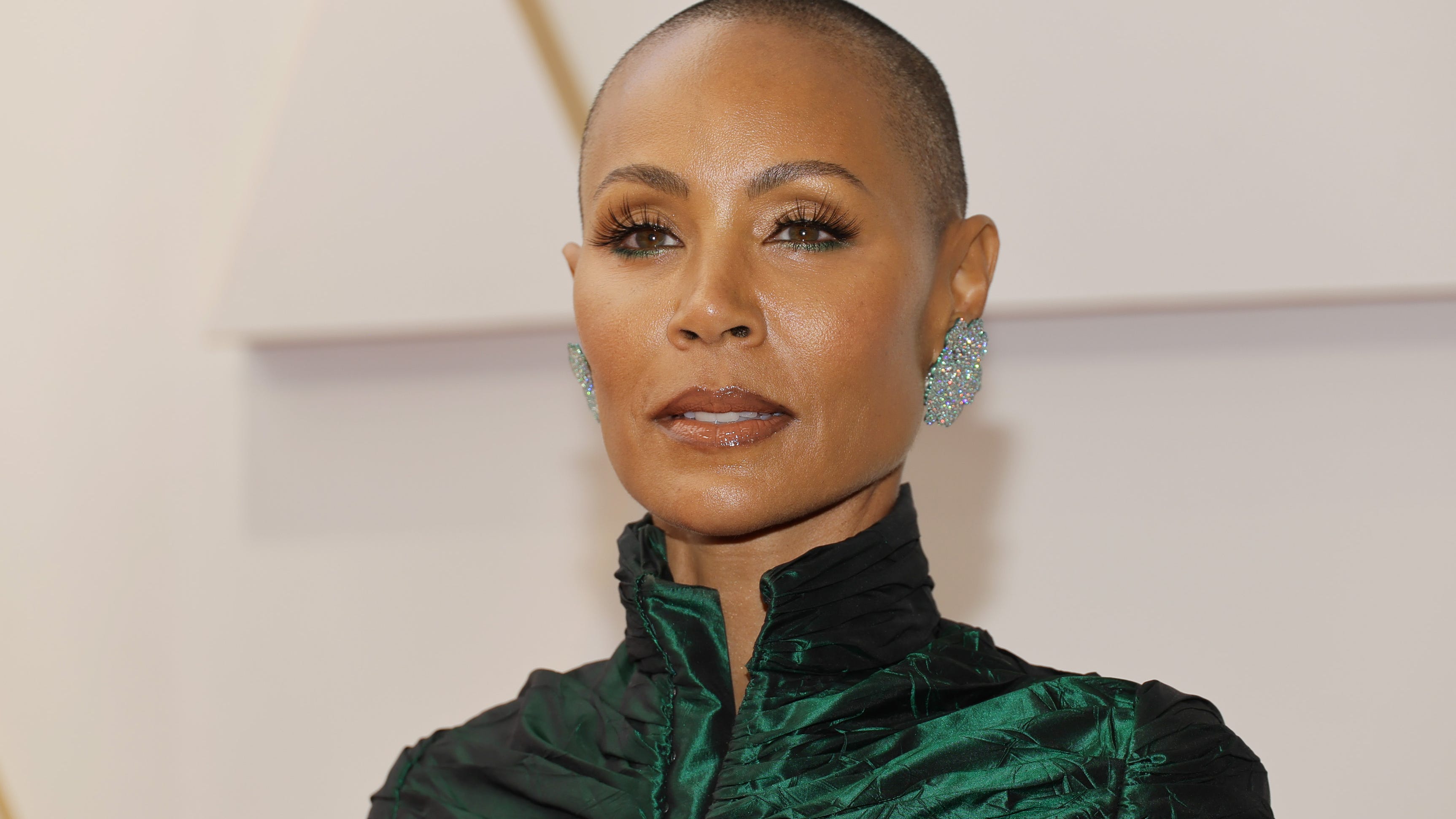 Ask The Expert: What is Alopecia?